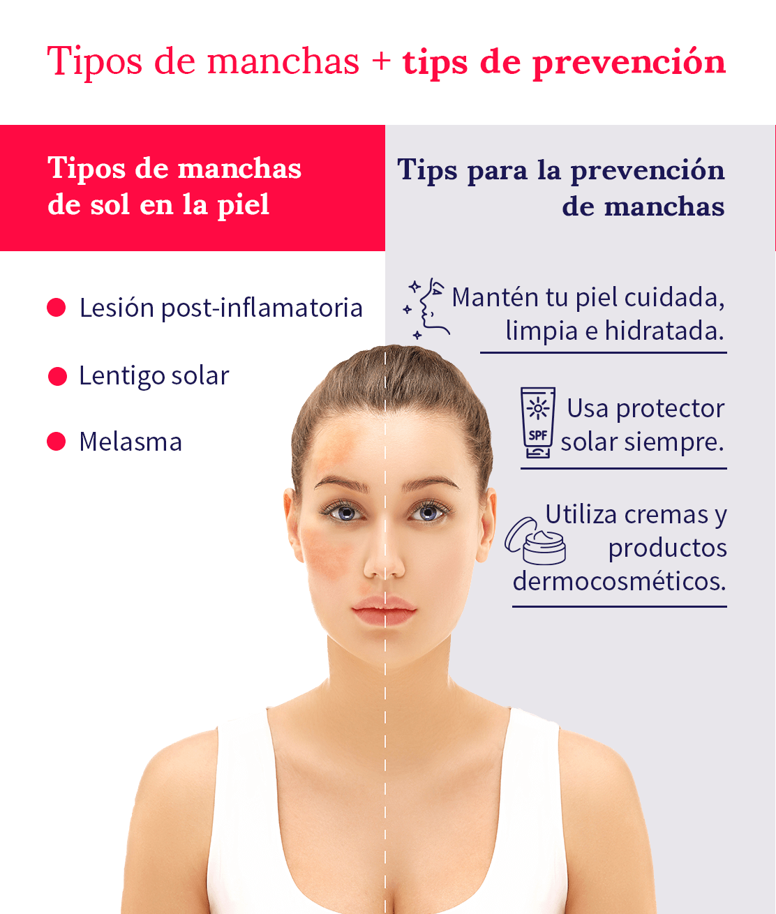 tipos-de-manchas-y-tips-de-prevención