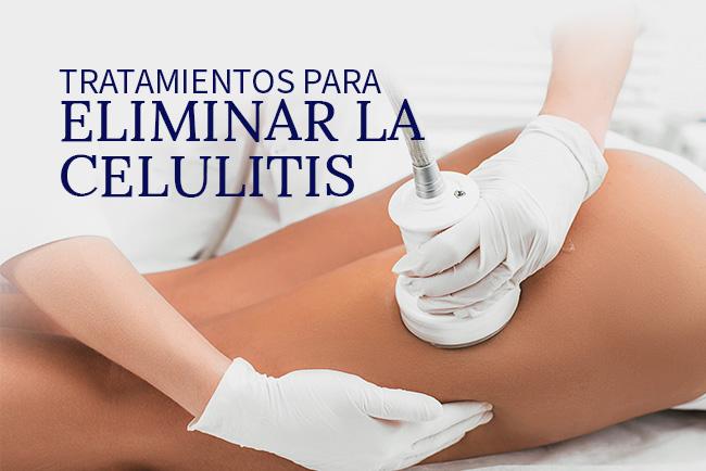 tratamientos-para-eliminar-la-celulitis