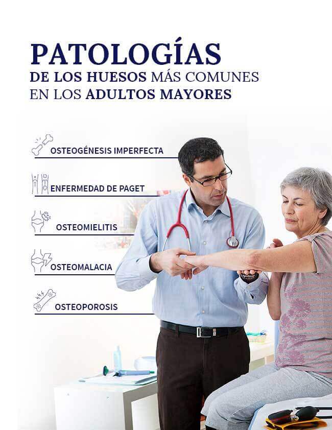 patologias-de-los-huesos-mas-comunes-en-adultos-mayores