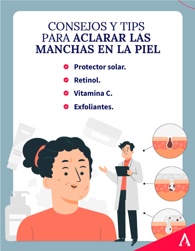 consejos-y-tips-para-aclarar-las-manchas-en-la-piel