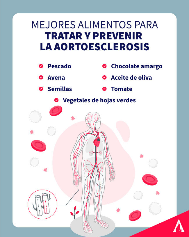 mejores-alimentos-para-tratar-y-prevenir-la-aortoesclerosis- 