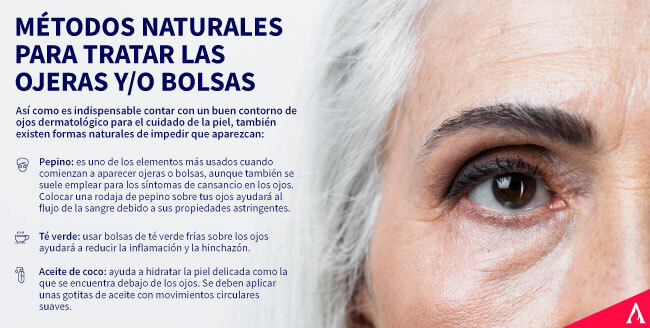 metodos-naturales-para-tratar-las-ojeras-y-bolsas