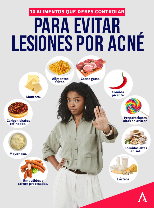 como evitar lesiones por acne